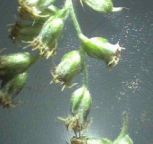Moxxa Plant under the Microsope